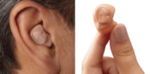 Siemens hearing aid dealers in Chennai